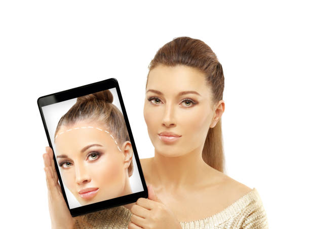 Natural results after FUE hair transplant
