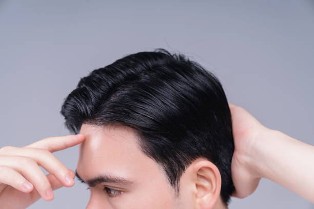 Confident patient after hair transplant