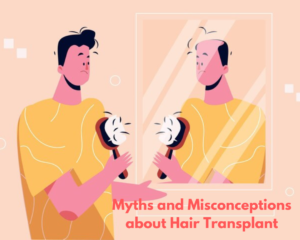 Hair Transplant Myths and Misconceptions