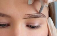 Eyebrow Hair Transplants