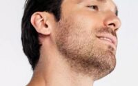 Beard Hair Transplant