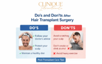 Do’s and Don’ts After Hair Transplant Surgery
