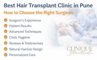 best Hair Transplant Clinic in Pune